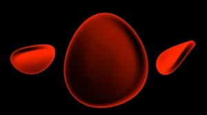 СРОЧНОЕ СНИЖЕНИЕ УРОВНЯ ХОЛЕСТЕРИНА?ИСЦЕЛЕНИЕ ЗВУКОМ?ЛЕЧЕБНЫЕ ЧАСТОТЫ (Гц)