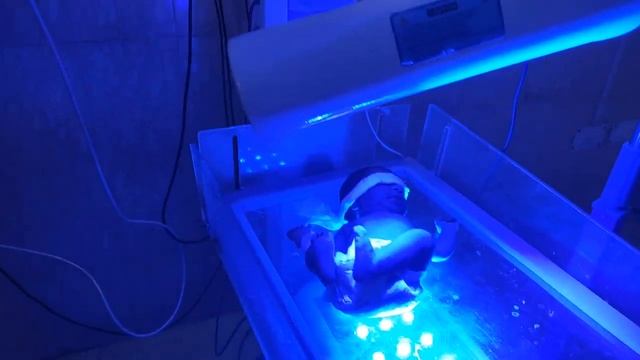 Phototherapy Treatment For Jaundice | Phototherapy In Newborn