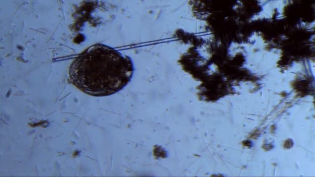 Дафния (Daphnia) и Эвглена (Euglena) смотреть онлайн