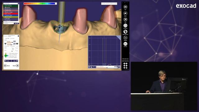 INSIGHTS 2018: DentalCAD Software Session by Friedemann Stang смотреть онлайн