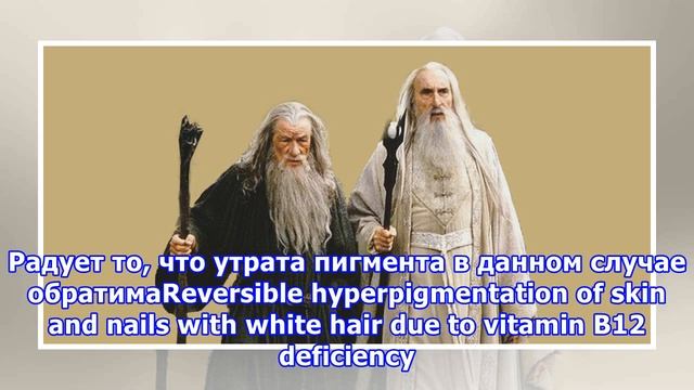 Почему появляются седые волосы и как от них избавиться смотреть онлайн