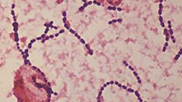 Streptococcus Mitis смотреть онлайн