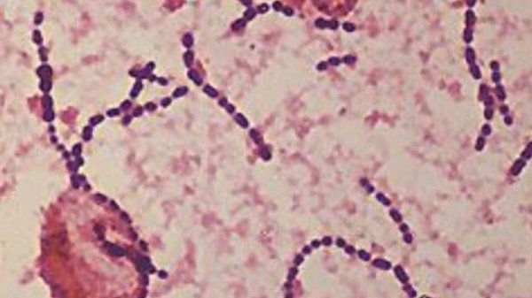 Streptococcus Mitis