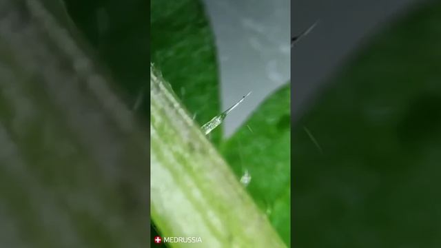 Крапива под микроскопом смотреть онлайн