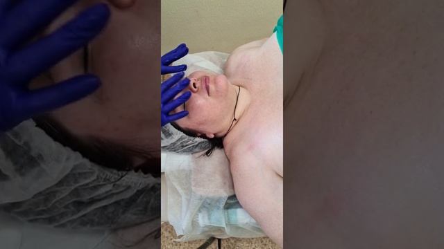 Массаж лица сахарным гелем и пилинг (чистка) лица смотреть онлайн