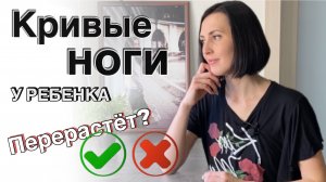 Кривые ножки у ребенка до года. Могут ли выпрямиться ноги с возрастом?