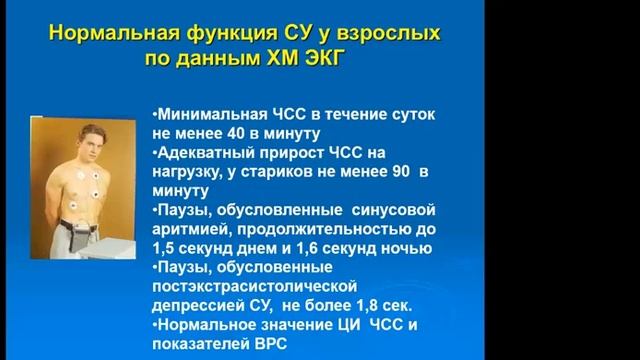 22 03 22 Куприянова АВ Синдром слабости синусового узла смотреть онлайн