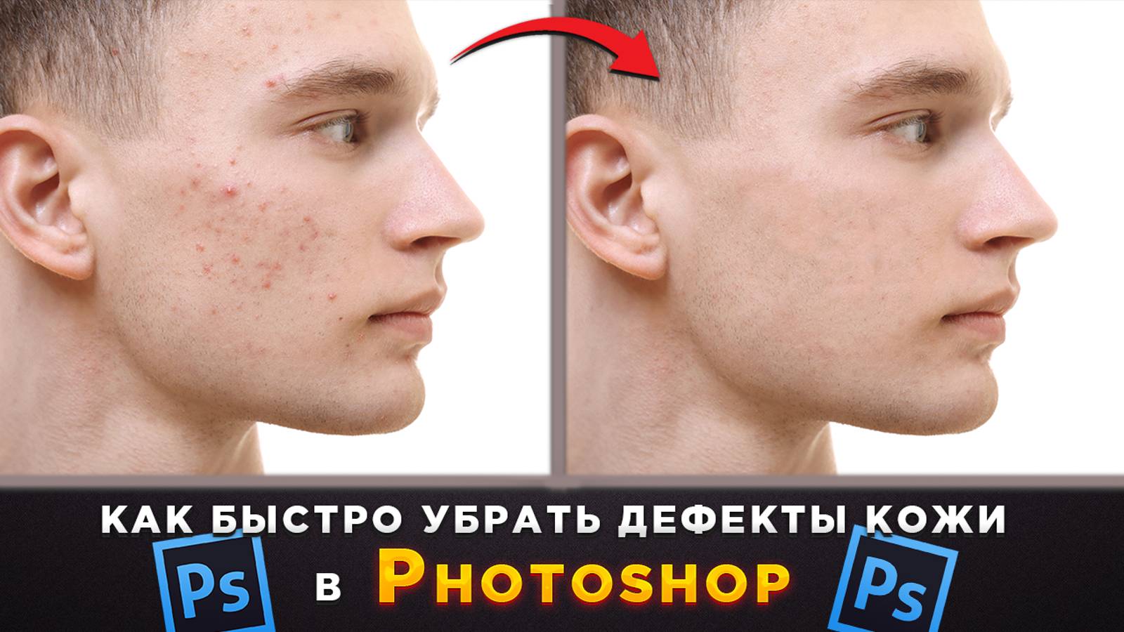 Как убрать прыщики, ретушь лица в Фотошопе Photoshop смотреть онлайн