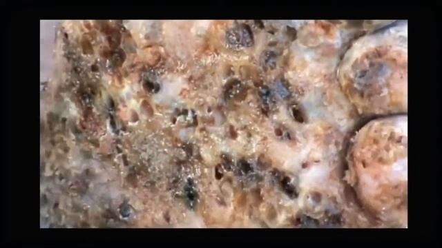 Тунгиоз поразил ногу.