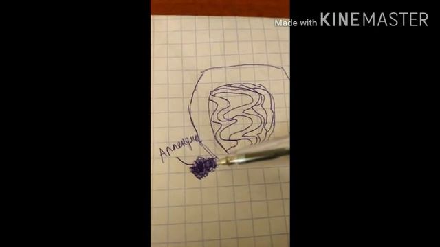 Апендицит. Что делать и как лечить смотреть онлайн