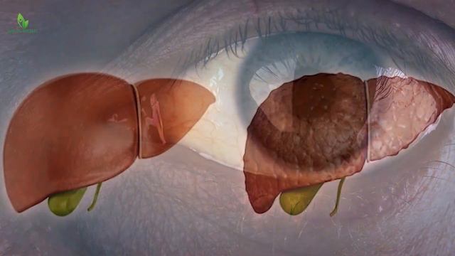 Benefits of Milk Thistle | Urdu/Hindi | Dar ul Hikmat Urdu | DUH смотреть онлайн