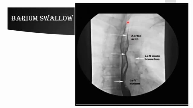 Radiological anatomy (plain X-ray & barium) of GIT смотреть онлайн