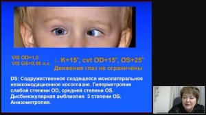 Косоглазие.mp4
