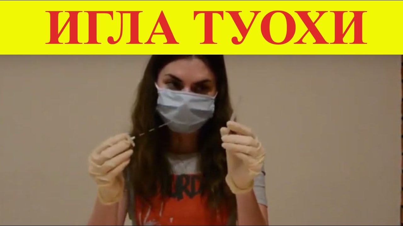 Игла Туохи (эпидуральная анестезия)