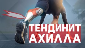 Тендинит Ахиллова сухожилия? Болит голеностоп?