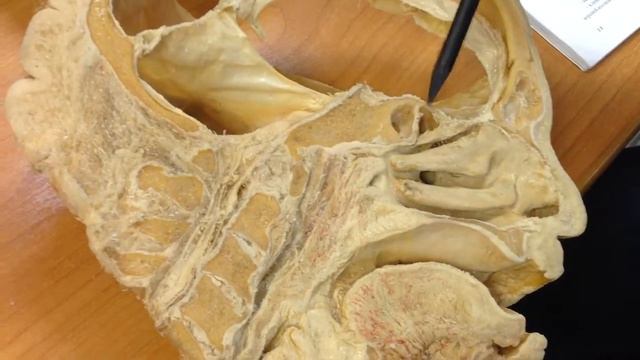 синусы смотреть онлайн