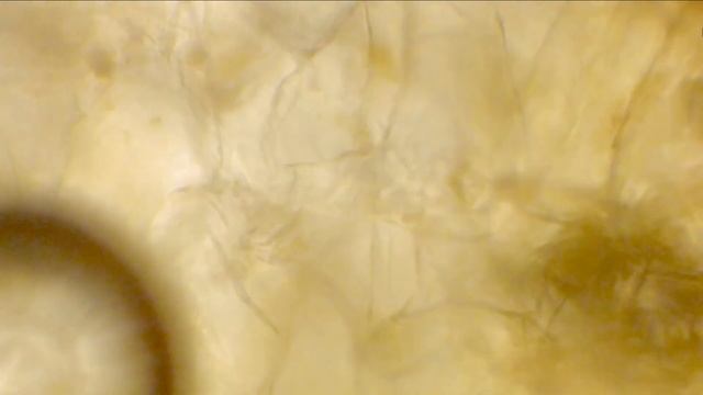 Яблоко. Проверка на рост грибка. Под микроскопом смотреть онлайн