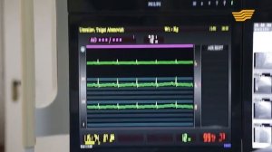 Что такое коронарография?