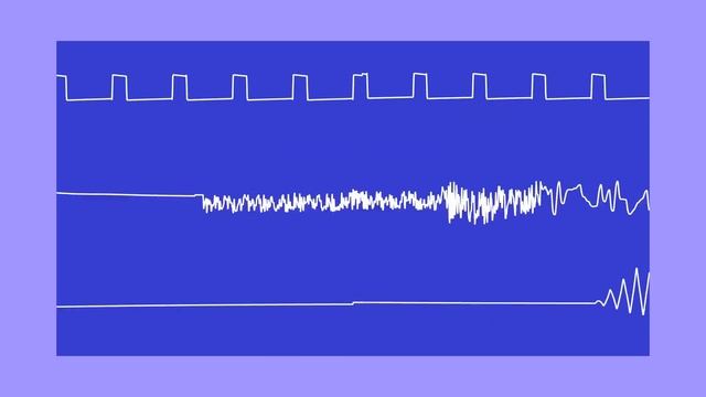 SONIC C64 [PAL] - Green Hill Zone - 8-Bit - SID Music (Oscilloscope View) смотреть онлайн