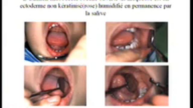 41 Sémiologie Stomatologique смотреть онлайн