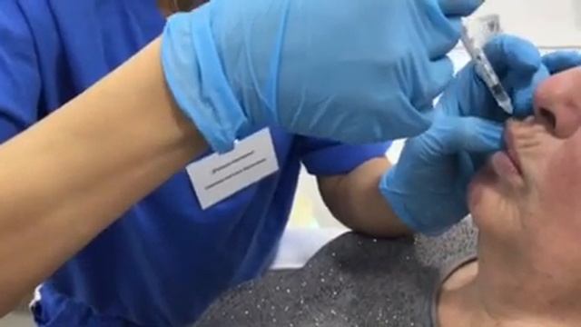 Устранение ботулотоксином кисетных морщин в Sonet Clinic смотреть онлайн