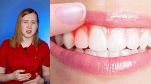 Зубные ершики ✨ ВСЁ О ГИГИЕНЕ ЗУБОВ