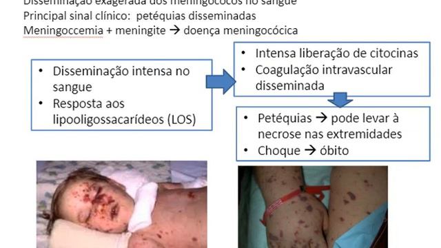 Aula Neisseria meningitidis e Haemophilus influenzae - UFRJ Macaé смотреть онлайн