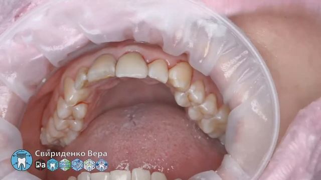 Professional oral hygiene case 006 DTE D7 Acteon Air-N-Go FloWeis Cleanic Enhance (FHD multistream) смотреть онлайн