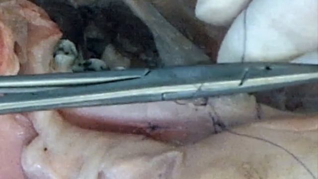 23.04.16. Мария Носова. Практикум по пластике десны. Эпизод 6 смотреть онлайн