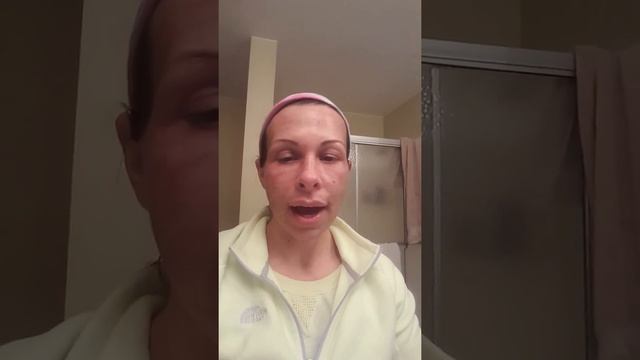 Active FX Fractional CO2 laser skin resurfacing treatment смотреть онлайн