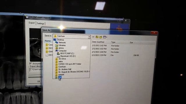 How to export DICOM data from a Sirona CBCT (Sidexis, Galileos, Dolphin software) смотреть онлайн