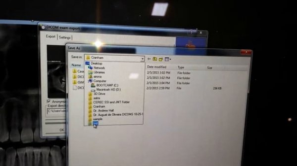 How to export DICOM data from a Sirona CBCT (Sidexis, Galileos, Dolphin software)