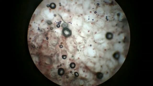 Какие арбузы безнитратные?Проверка нитратов в арбузах. смотреть онлайн