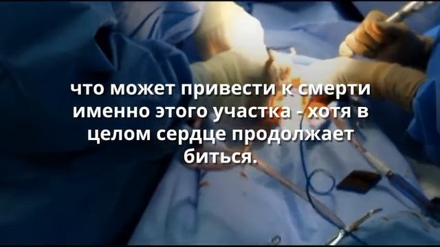 Ученые подтвердили: умершие понимают, что их «больше нет» и полностью ощущают окружающий мир смотреть онлайн
