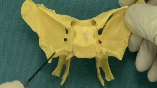 1.14 Step 24. Pterygoid canal and pterygopalatine fossa смотреть онлайн