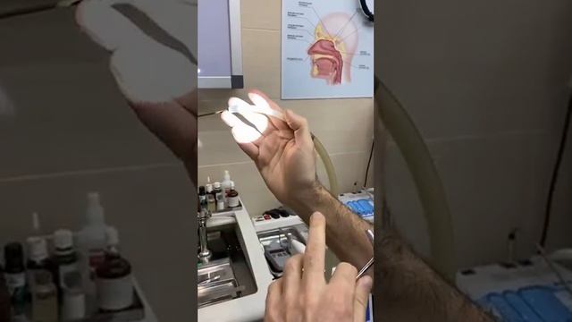 Туалет и санация полости носа смотреть онлайн