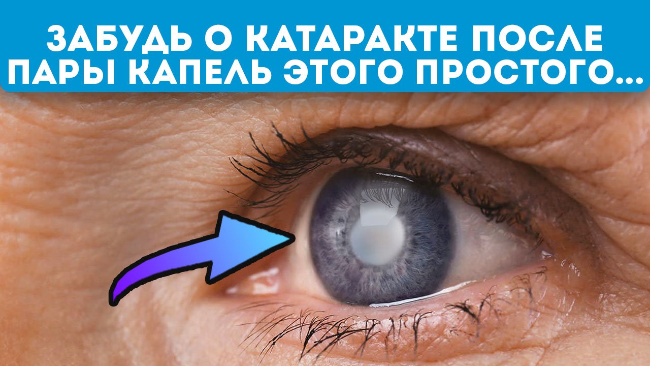 Окулисту лишь бы сделать операцию! Вот эти народные средства помогут при катаракте смотреть онлайн