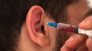 СЛОМАЛ УХО В ЗАЛЕ ! ЧТО ДЕЛАТЬ ?