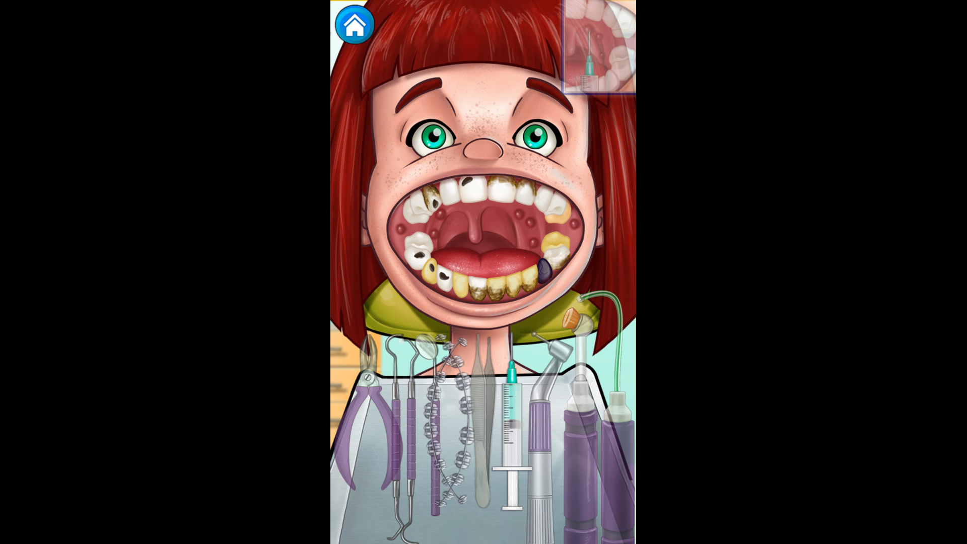 Что вы знаете о дырках в зубах? 😨 смотреть онлайн