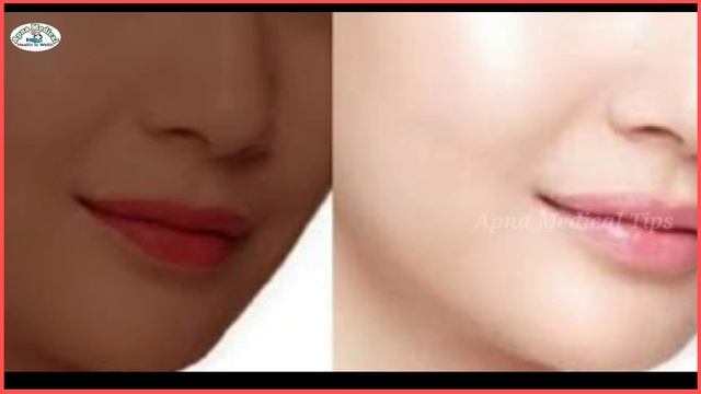 Fresh & shine cream | Rcm fresh & shine | fresh and shine cream review | गोरा होने की बेस्ट क्रीम смотреть онлайн