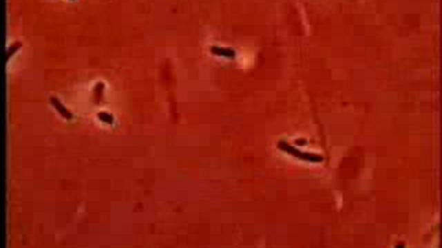 Щеплення: загроза чи необхідність? смотреть онлайн