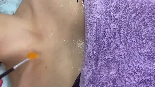 Красивое декольте, пигментация, чистка, морщины смотреть онлайн