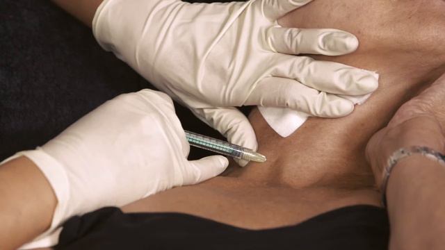 Lege Artis: Марва Сафа - личный опыт применения Juvederm Volite Allergan смотреть онлайн