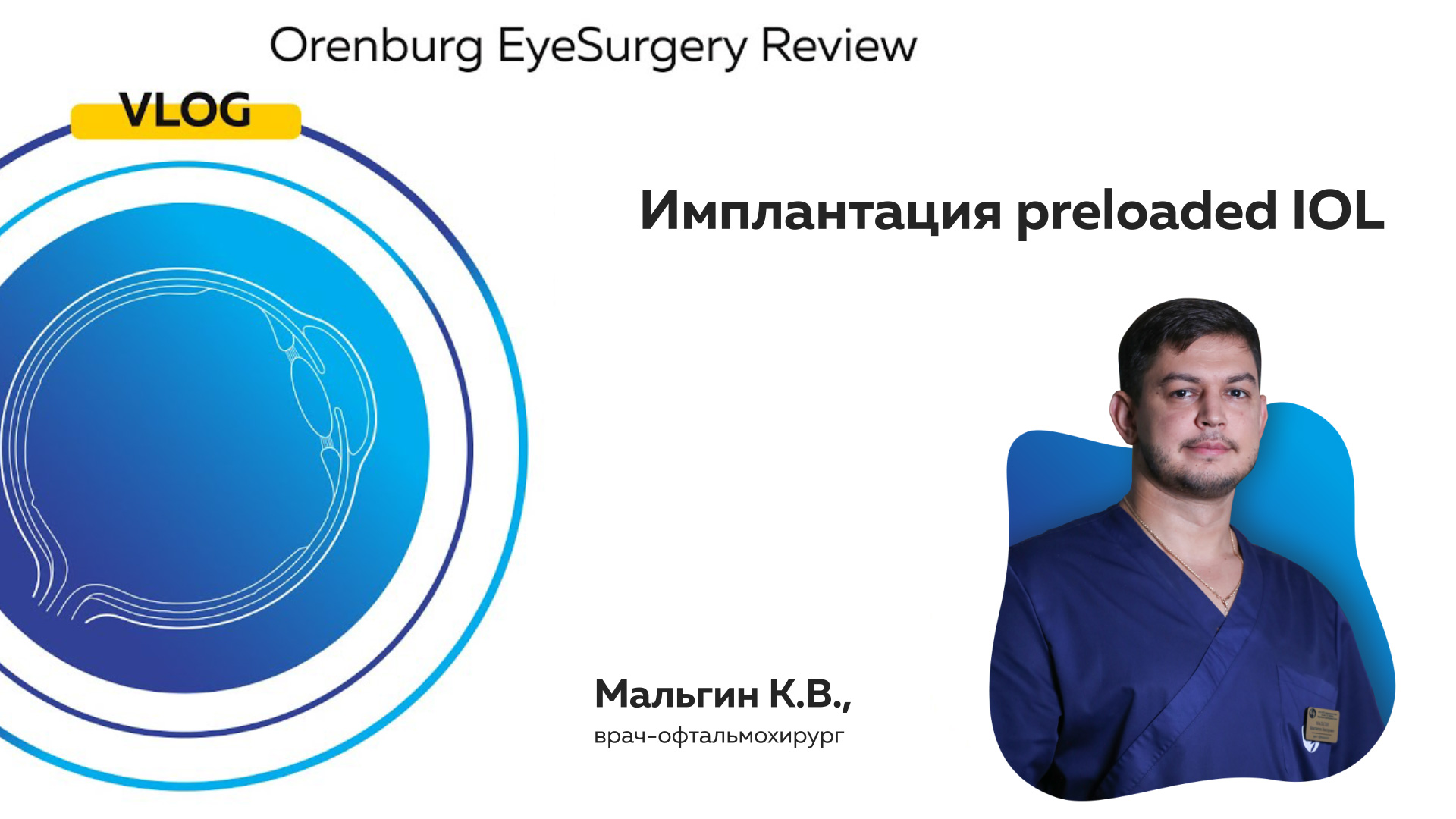 Имплантация Preloaded  IOL