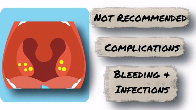 Tonsil Stones | Tonsil Stones Treatment | Tonsil Stone Removal - All You Need to Know смотреть онлайн