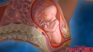 Что такое отслойка плаценты?