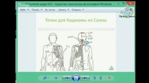 Точки для Хиджамы из Сунны | Обучение Хиджаме