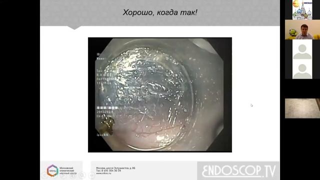 4. Недолужно И.Ю. ПОЭМ у больных, ранее оперированных на пищеводно-желудочном переходе. смотреть онлайн