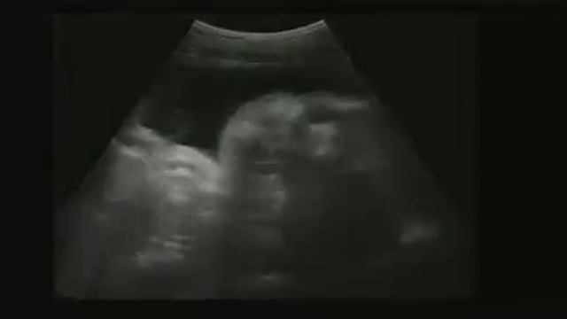 Плач младенца в утробе смотреть онлайн