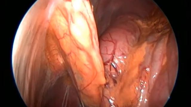 Введение лекарственной формы смотреть онлайн